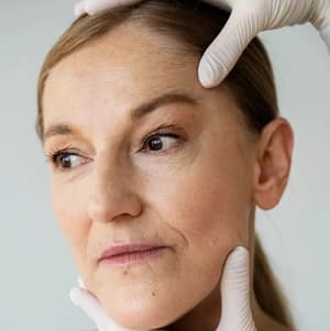 5 הטיפולים הטובים ביותר לחידוש עור הפנים